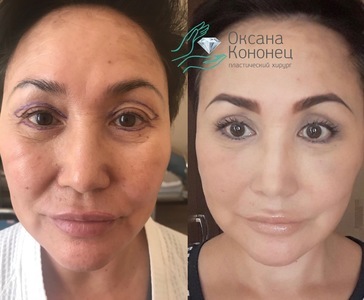 441d4bb0-be51-48f6-a384-e6168a2cd6e4